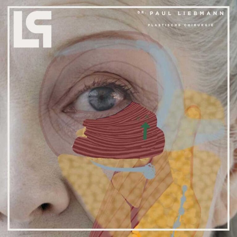 Unterlied Tränensack