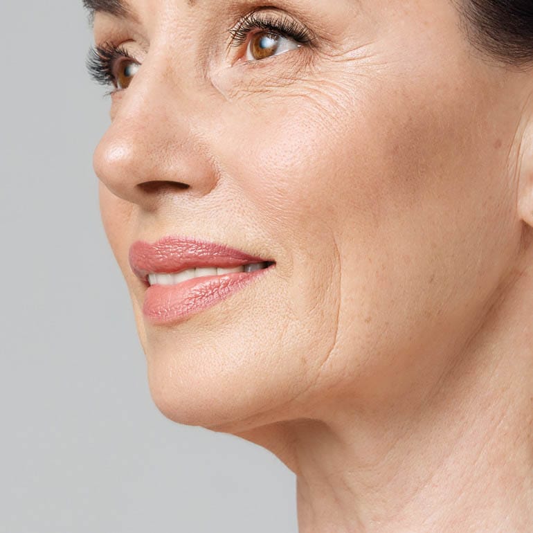 Bild Eigenfetttransplantation