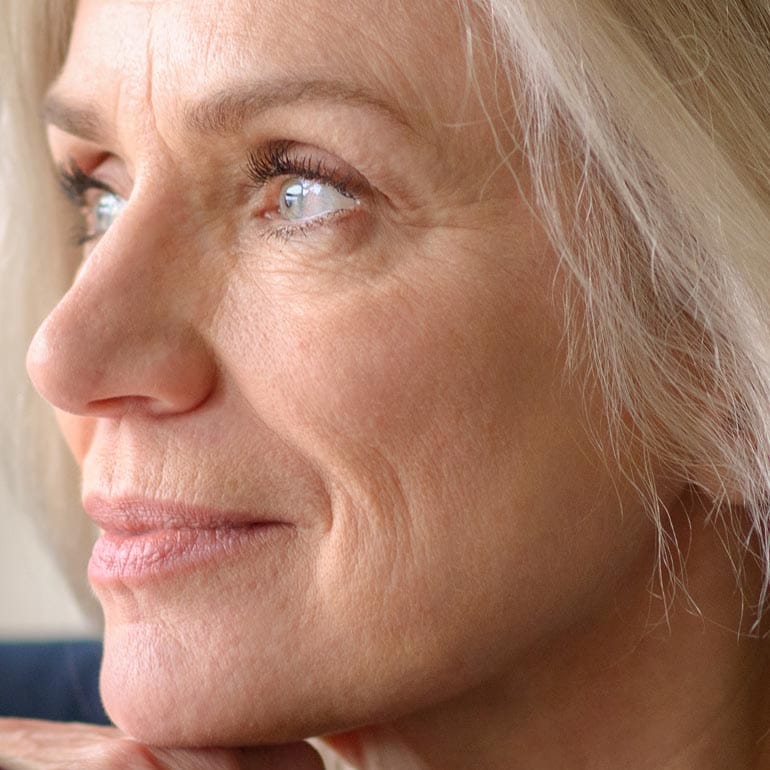 Nahaufnahme des Gesichts einer Frau nach Fadenlifting