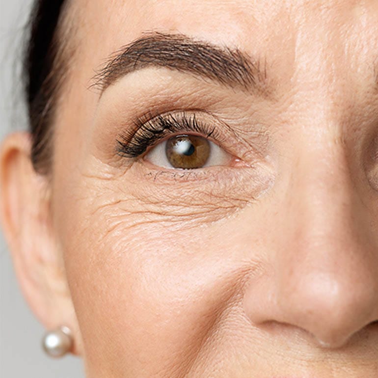 Frau schaut in Kamera