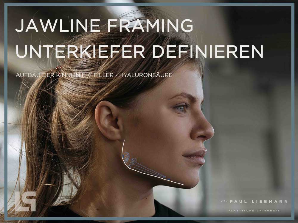 Aufbau Jawline Contouring