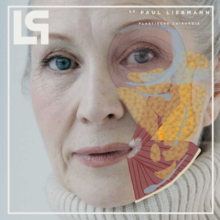 Beschreibung der Operation