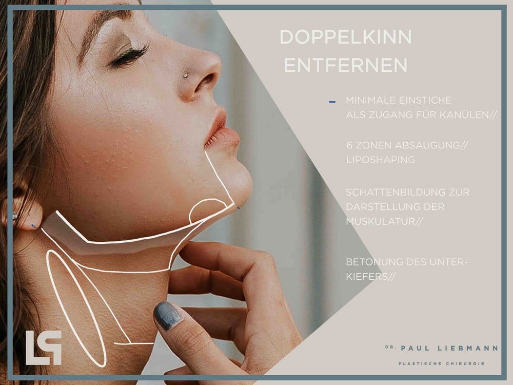 Frau auf Werbung