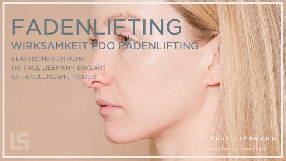 Fadenlifting PDO