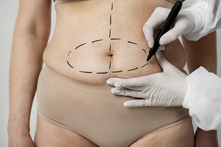 Bild zeigt Bauch Operation