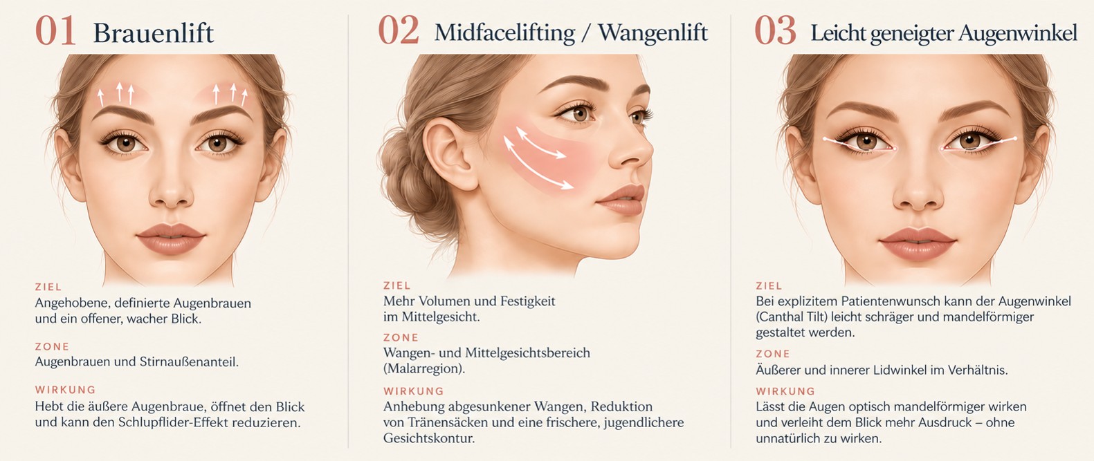 Grafik zum Thema Temporallifting