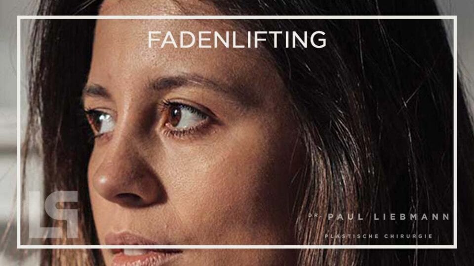 Fadenlifting