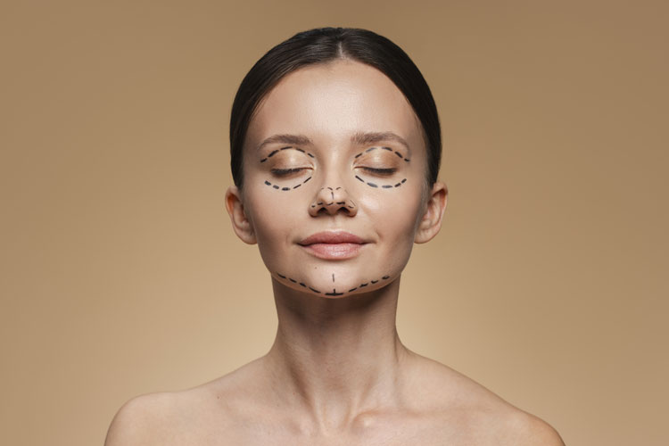 junge Frau mit Marks für ein Facelift
