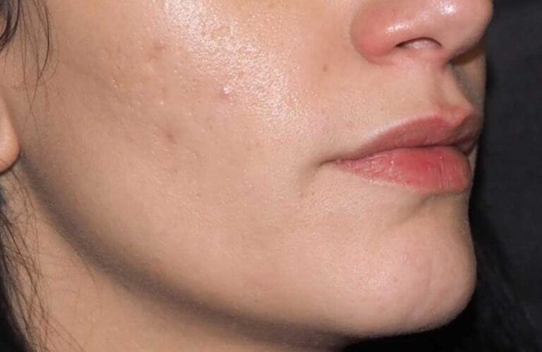 Frauen Lippen seitlich