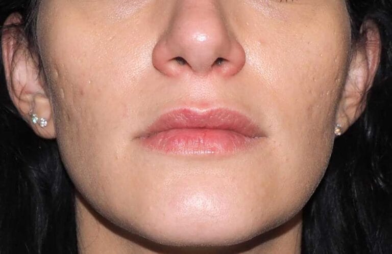 Frauen Lippen von vorne