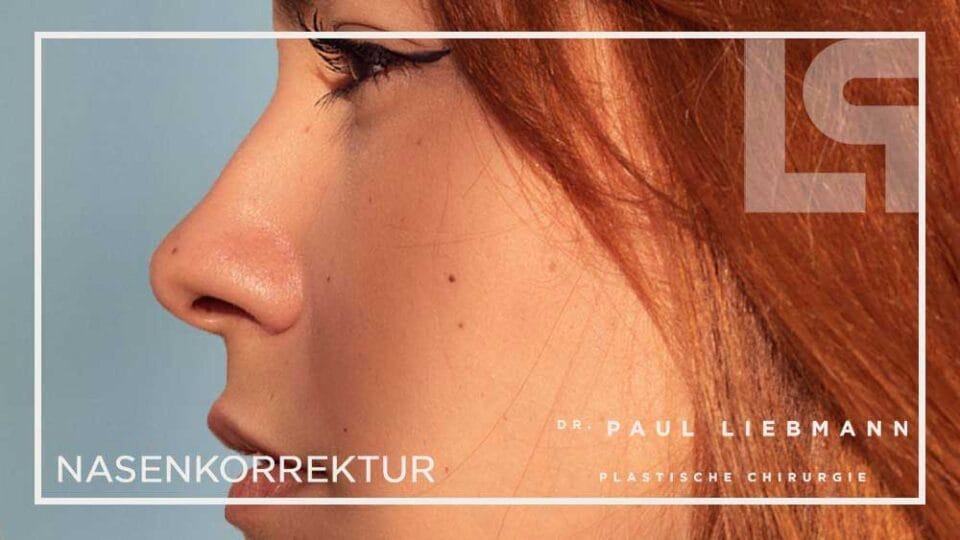 Nasen OP Wien