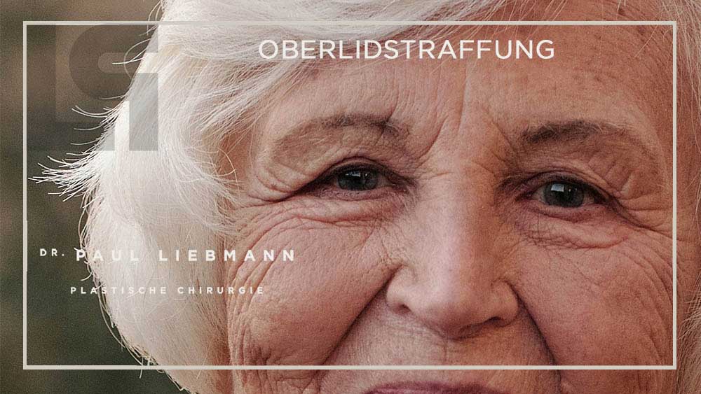 Oberlidkorrektur