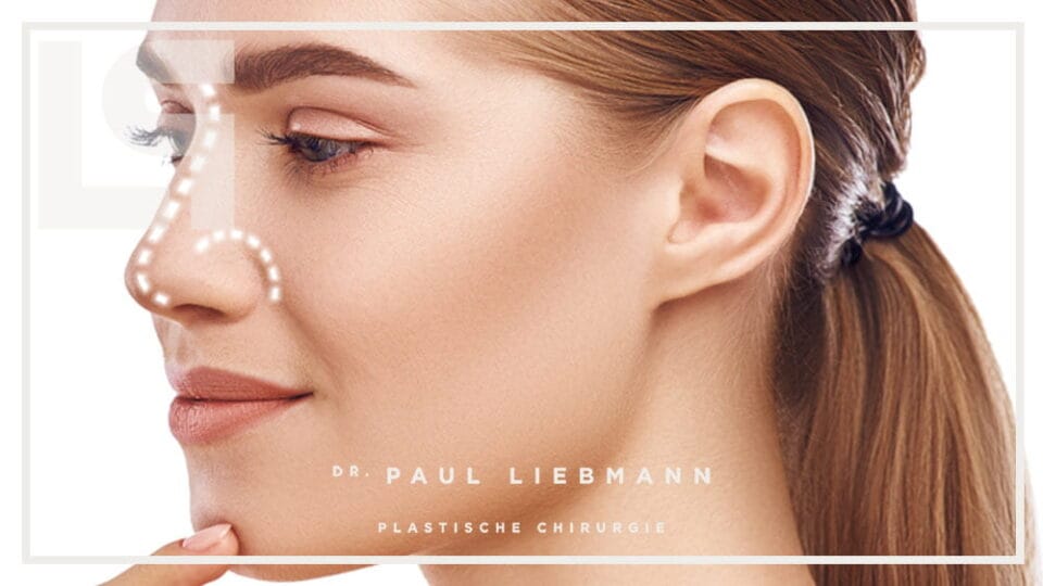 Bild zeigt Rhinoplasty