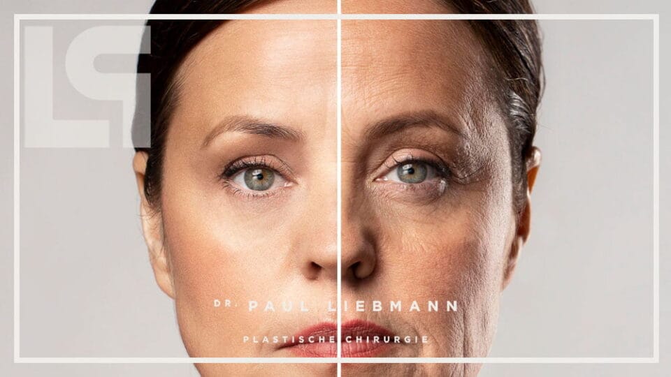 Bild zeigt Header Hautfalten