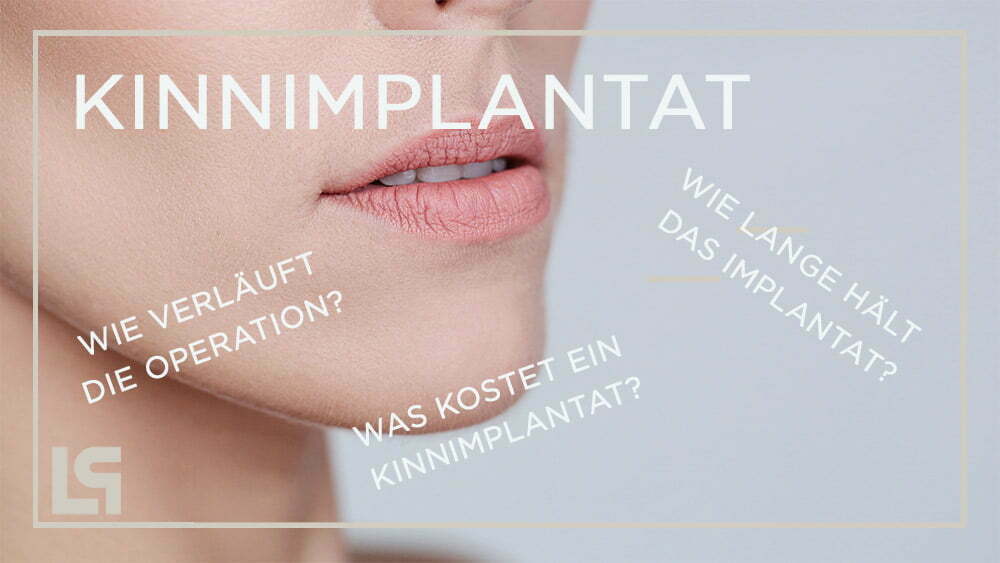 Bild zeigt Header Kinnimplantat