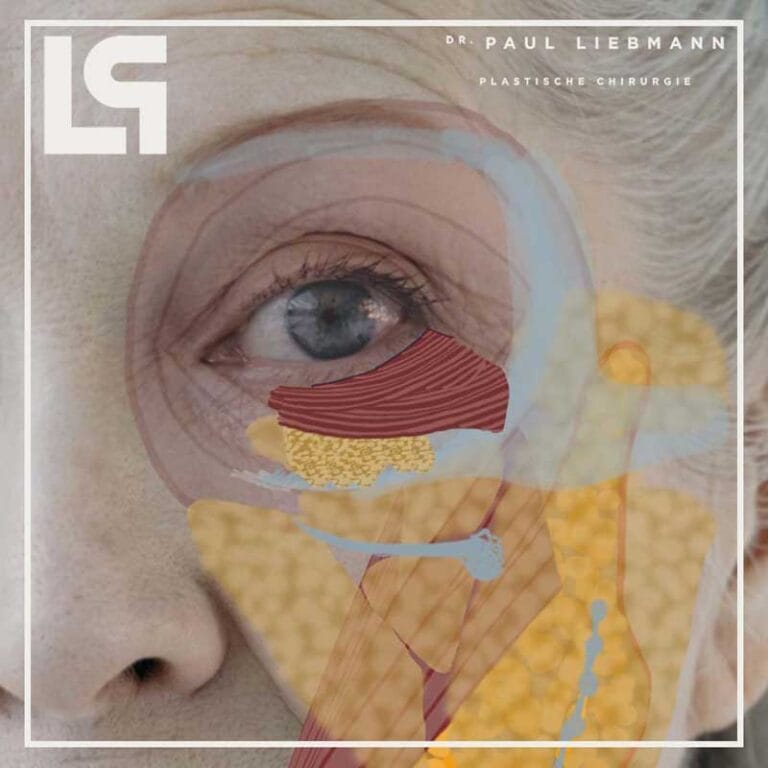 Abpräparation der Haut